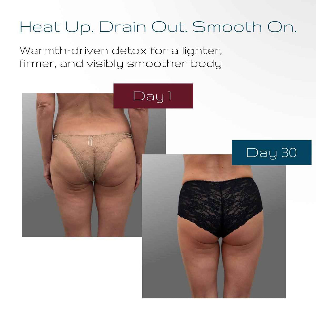 LYMPH8 Thermo Body Wrap